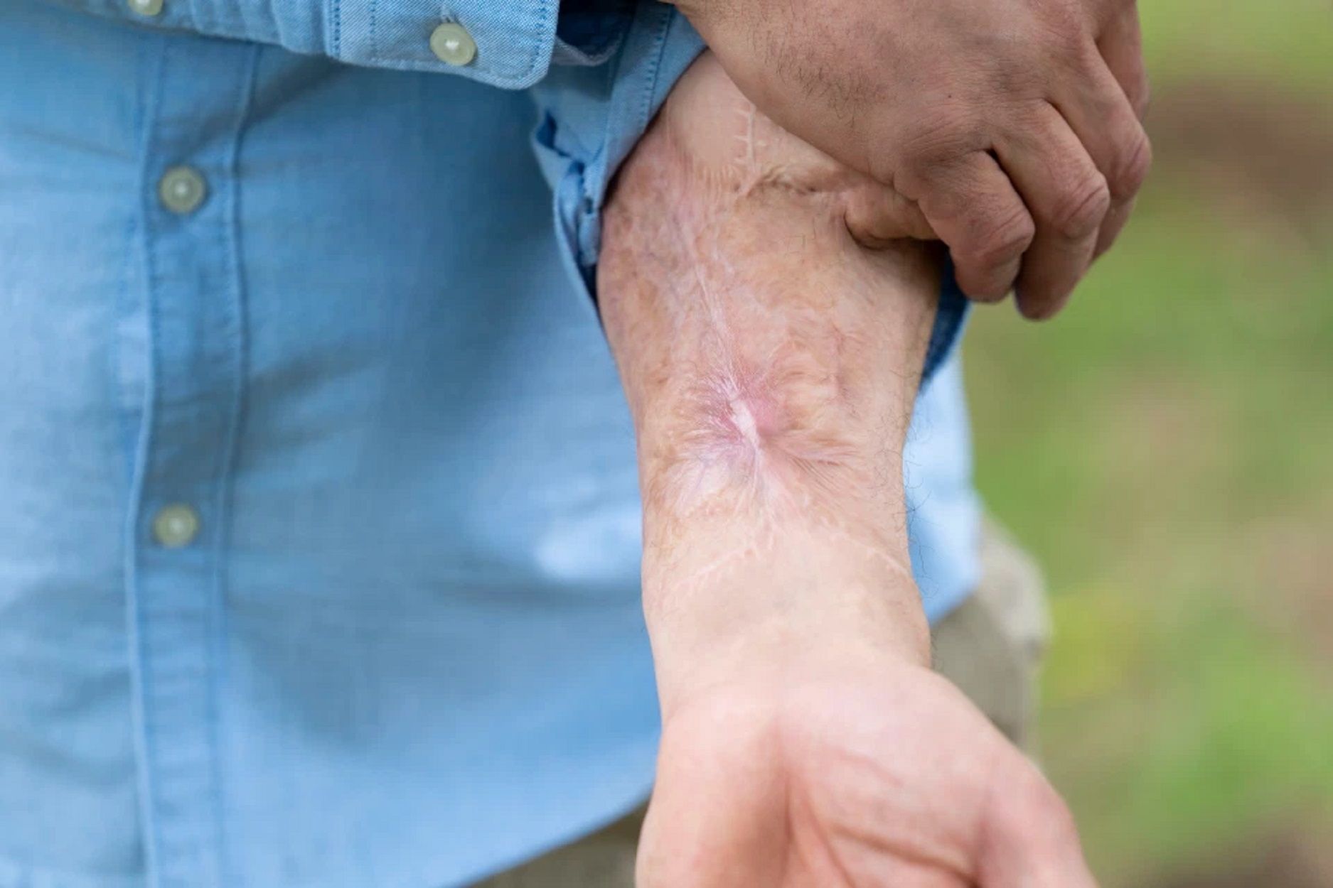 Hombre penen en el brazo 3 Hombre penen en el brazo 3