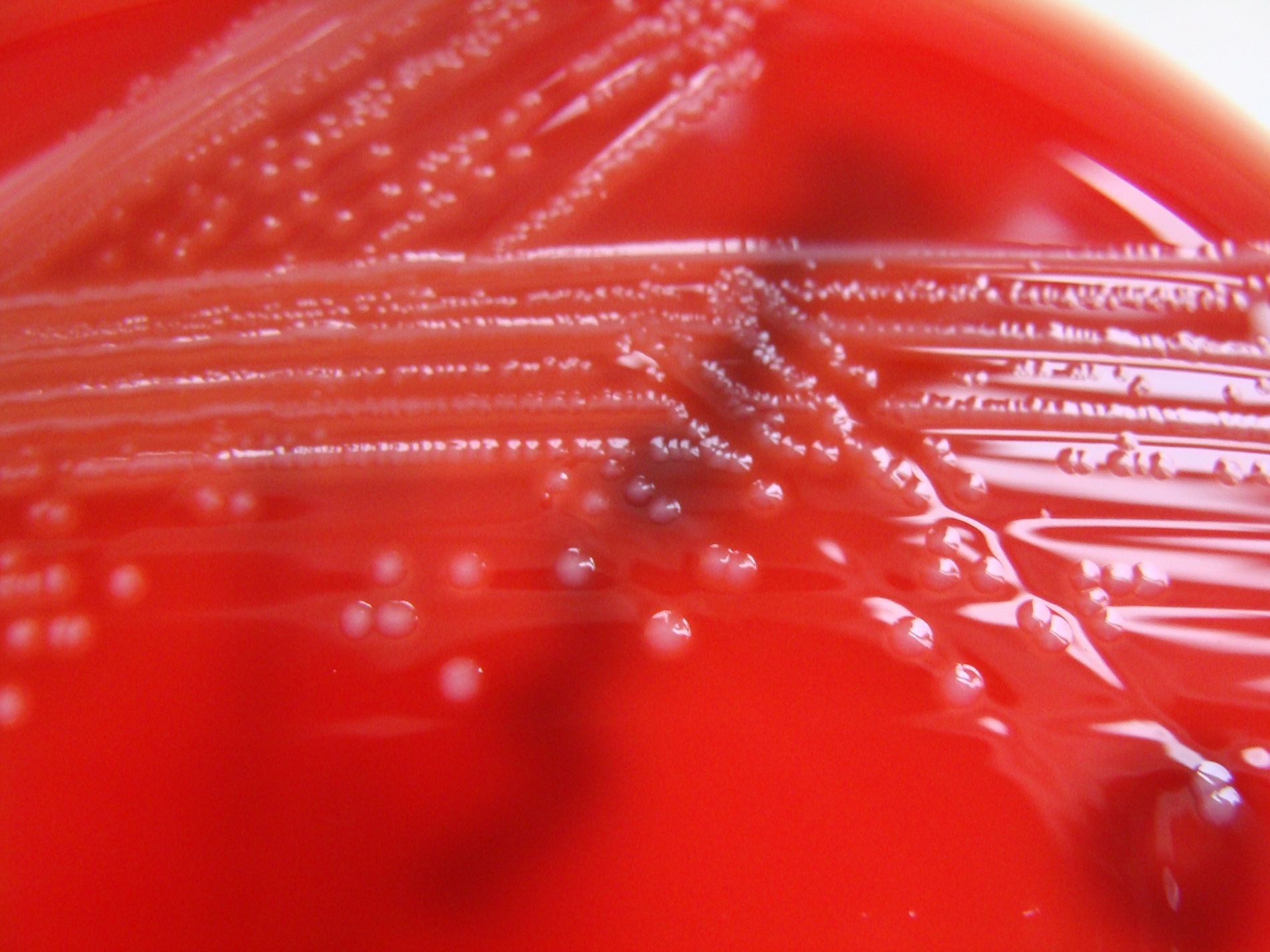 Listeria monocytogenes / Wikimedia Commons Listeria monocytogenes / Wikimedia Commons