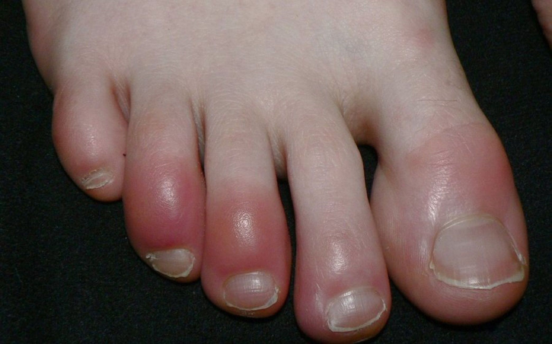 Dits congelats coronavirus / Arxiu|Arxivament Dits congelats coronavirus / Arxiu|Arxivament
