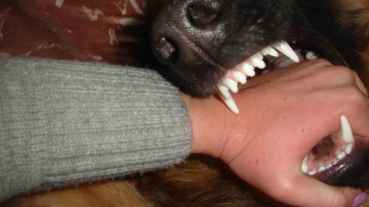 Mordedura de perro / Wikimedia Commons Mordedura de perro / Wikimedia Commons