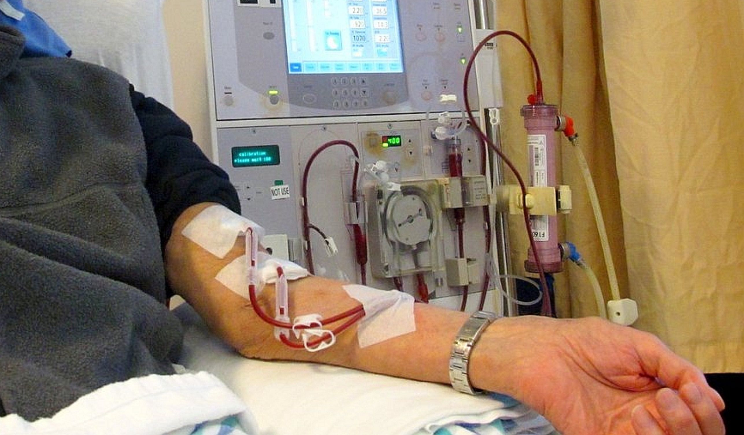 Dialisis / Wikimedia Commons