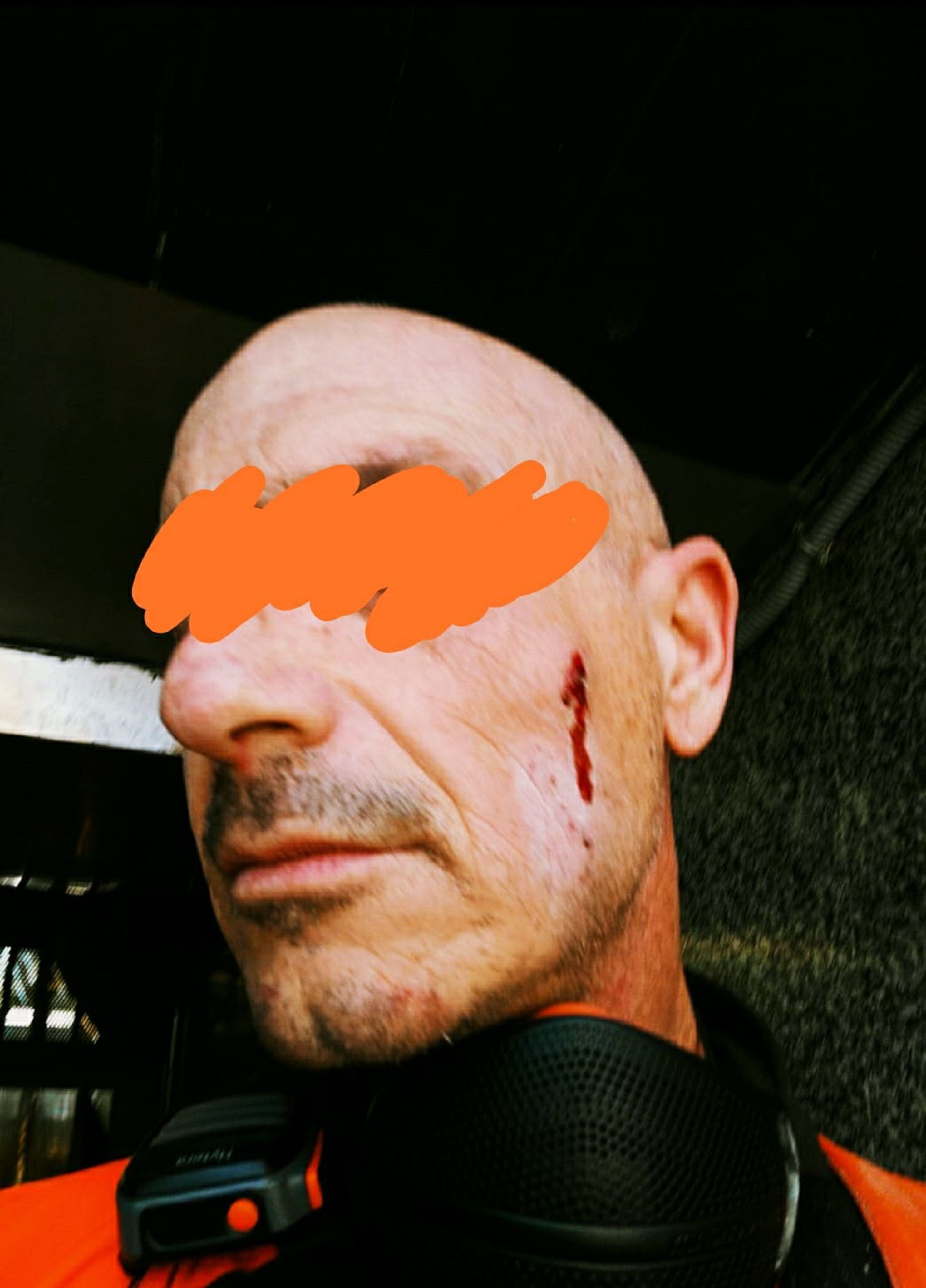 Vigilante seguridad agredido / Cedida Vigilante seguridad agredido / Cedida