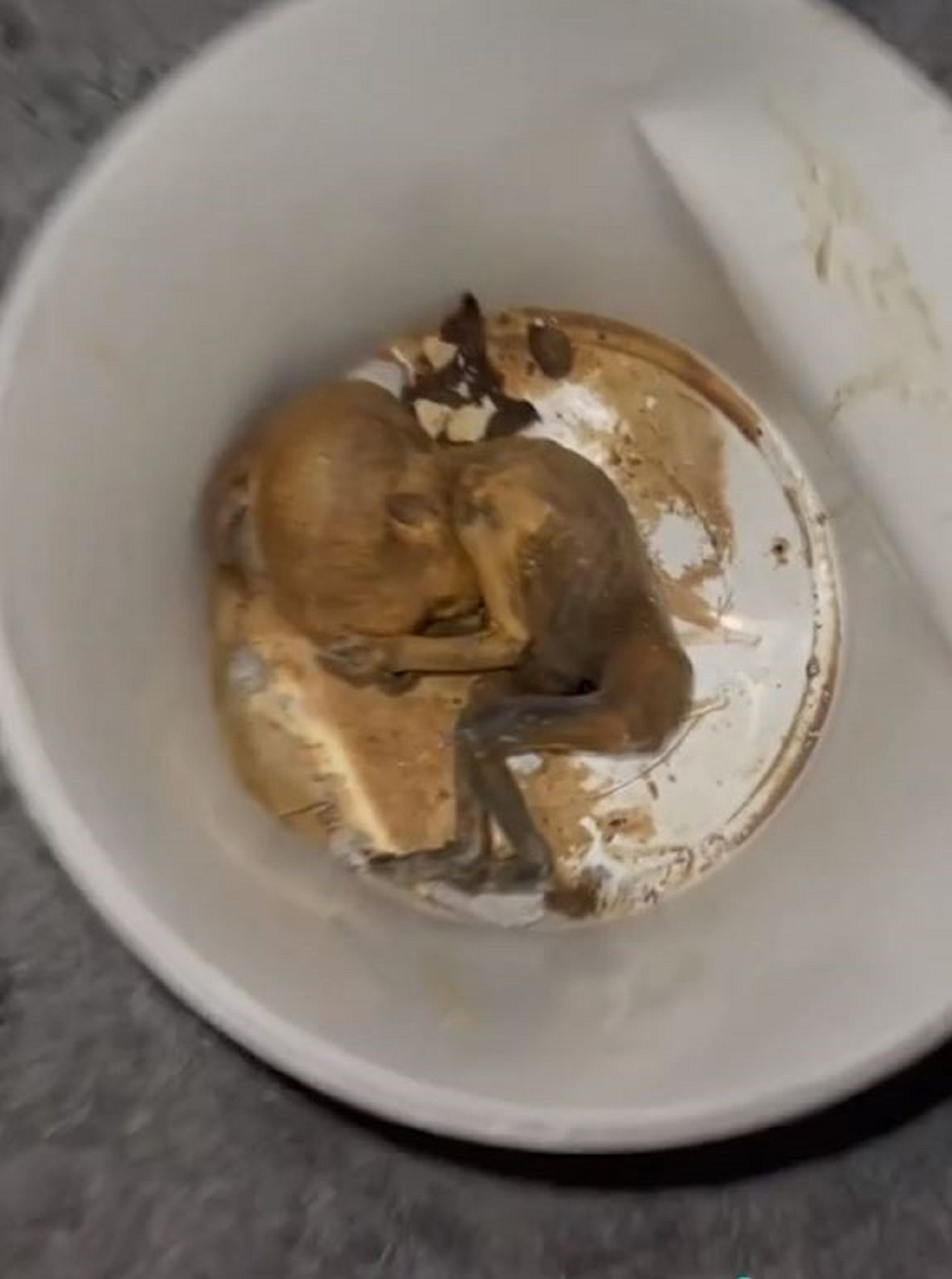 Fetus Hospital La Línea / TikTok Fetus Hospital La Línea / TikTok