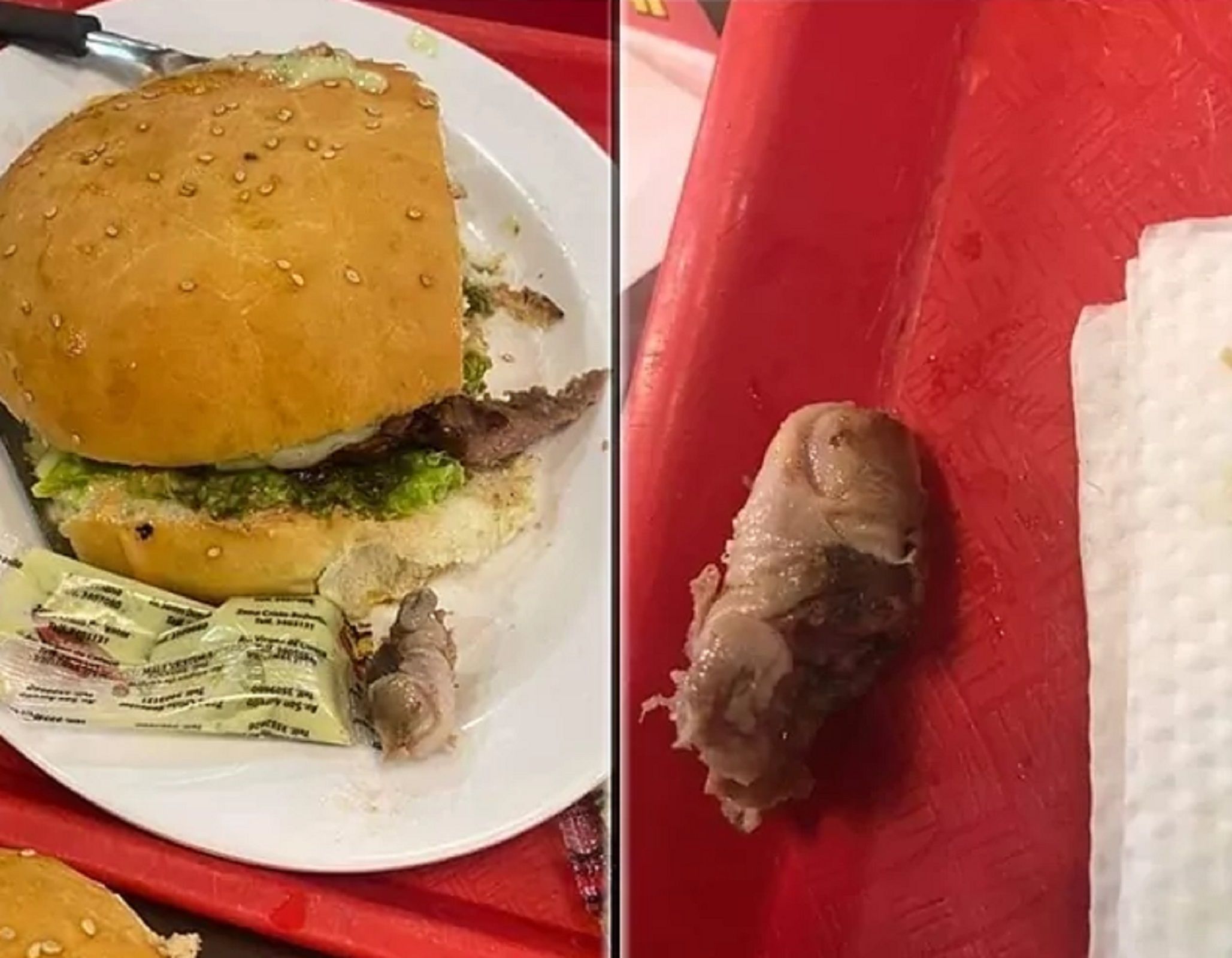 Dedo encontrado en una hamburguesa / RRSS Dedo encontrado en una hamburguesa / RRSS