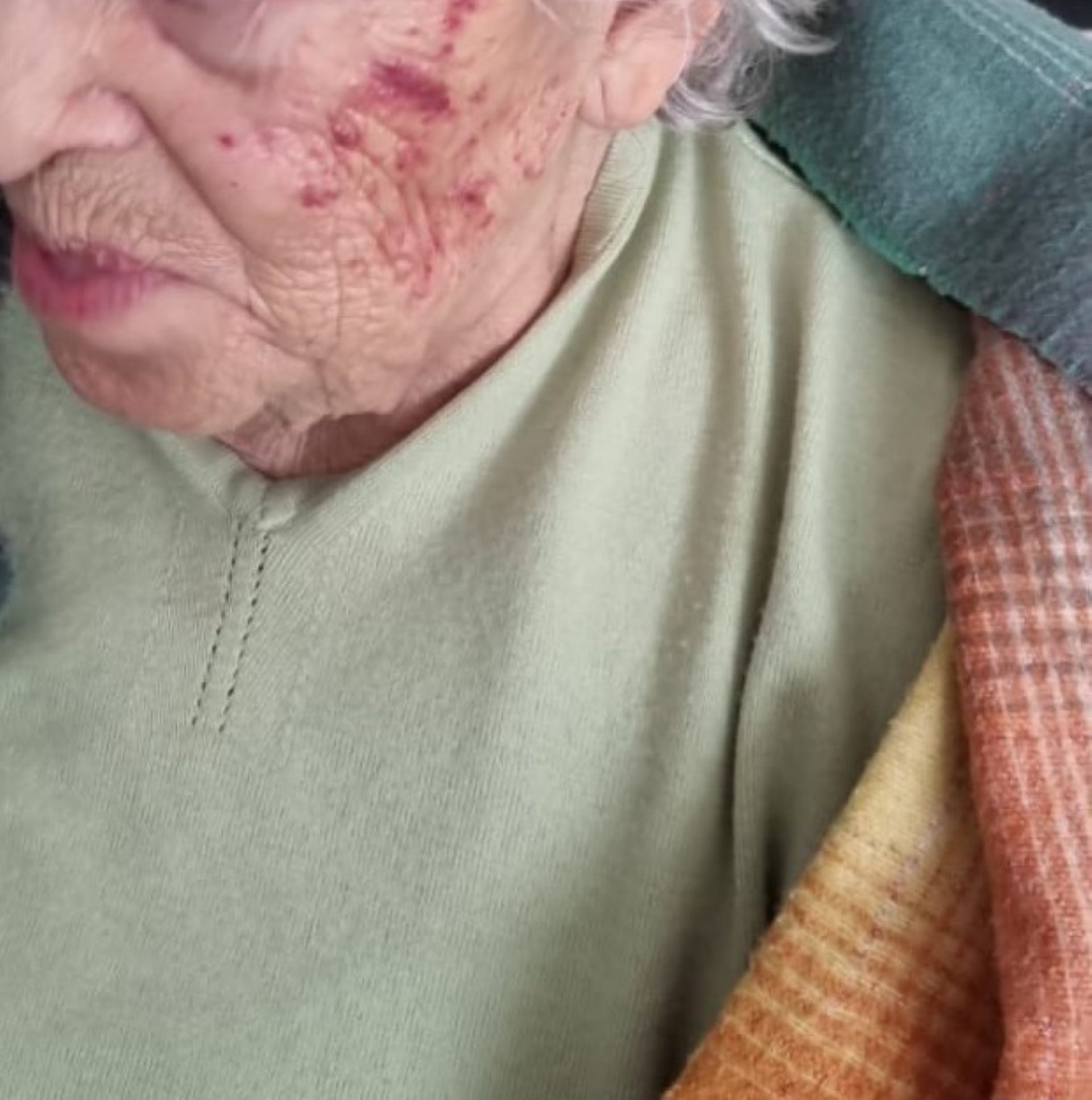 L'àvia agredida en una residència de Madrid / @LiileArroyo