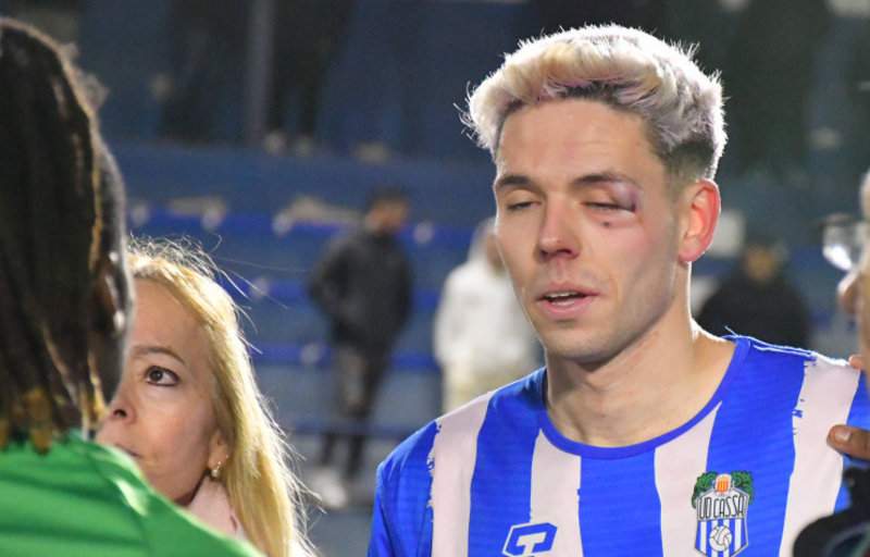 Brutal agresión en un partido de Tercera Catalana: un jugador propina un fuerte puñetazo en el ojo a otro