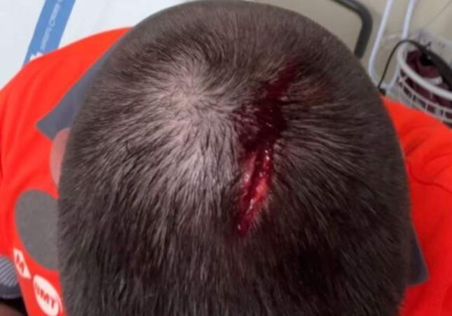 Imatge d'un dels vigilants de seguretat amb un trau al cap / Cedida