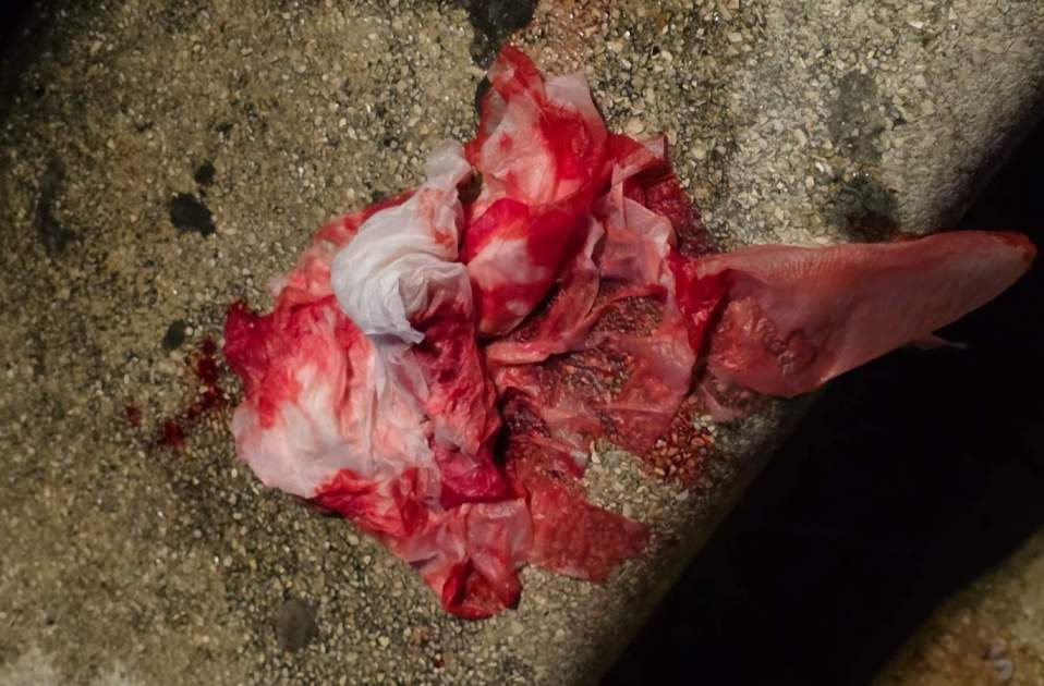 Pañuelo con sangre de la víctima