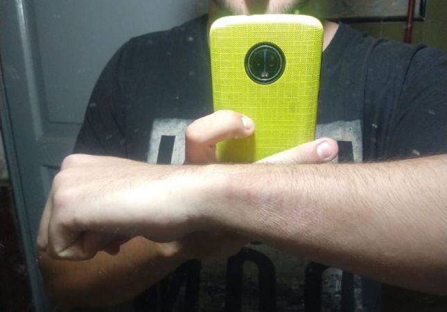 tatuatge esborrat tatuatge esborrat