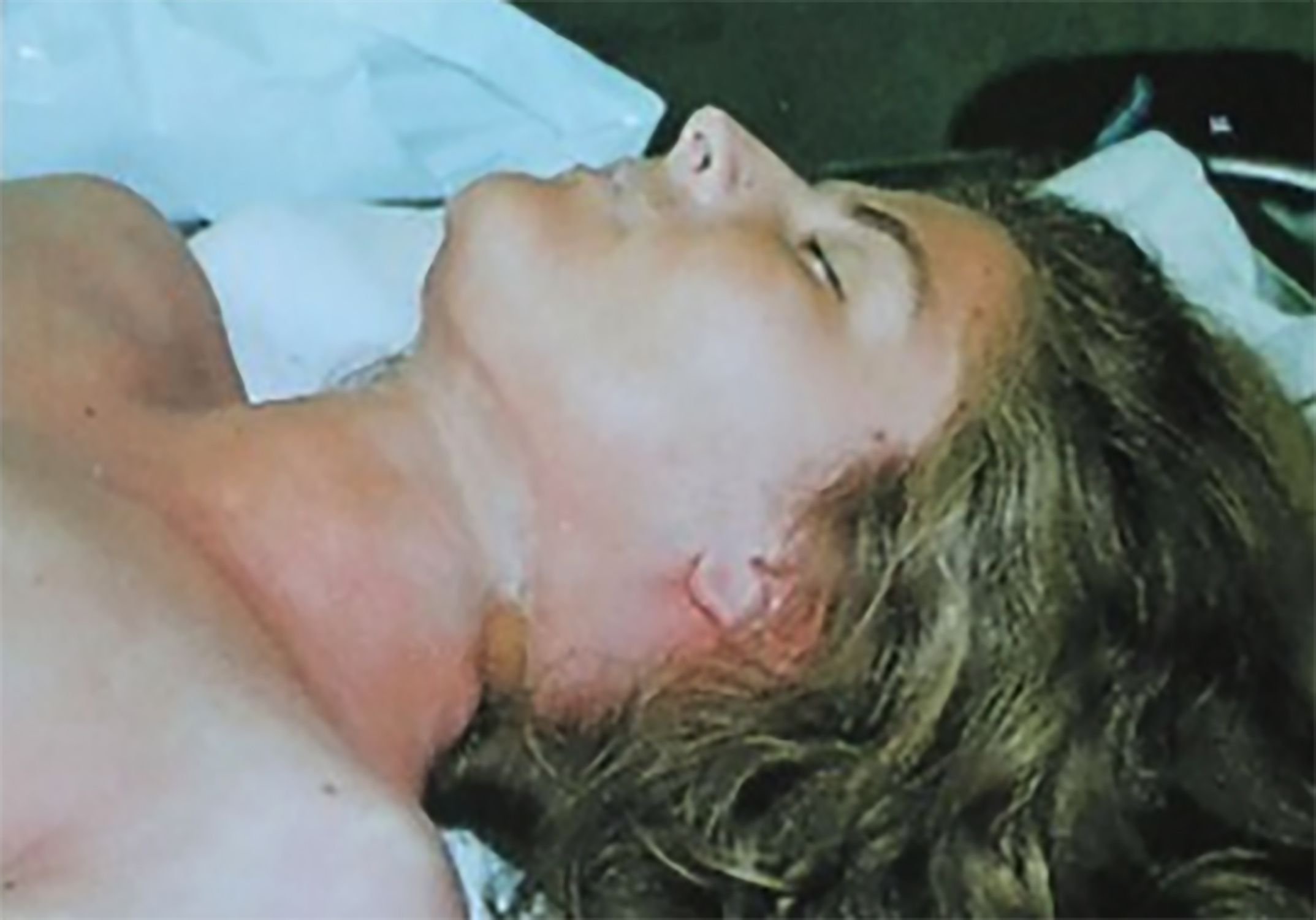 Chica Muerta Portbou Chica Muerta Portbou