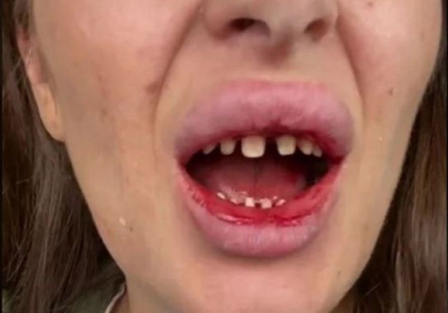 Les dents després de l'operació Twitter